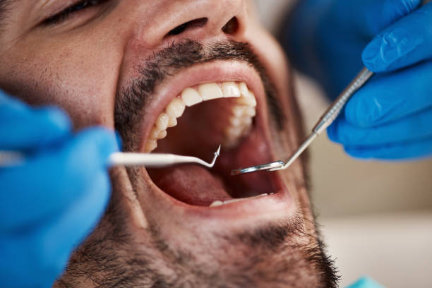 Best Mobile Emergency Dentist in Minden, LA
